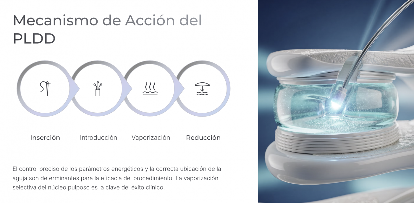 pldd-laser-1470-y-980-descompresion-discal